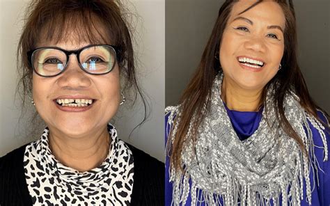Contact – Smile In A Day .